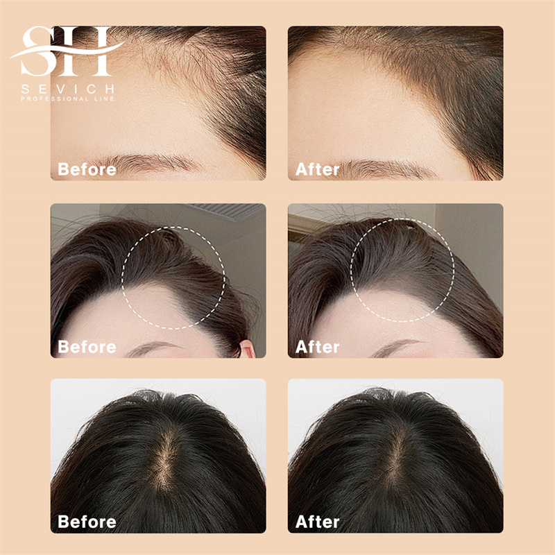 Hairline Shadow Powder Black R - Rooting Hormone Powder recension och pris
